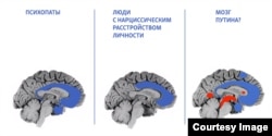 Сравнение областей мозга